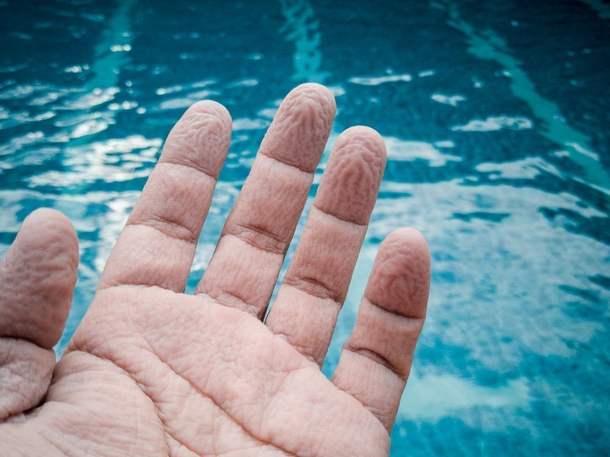 Почему после нахождения в воде на пальцах рук и ног появляются морщины